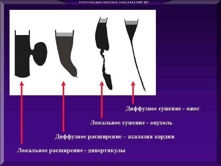 Р Е Н Т Г Е Н О Д И А Г Н О