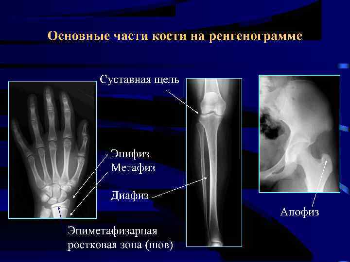 Рассмотрите рентгенограмму с изображением позвоночника человека как называют нарушение скелета