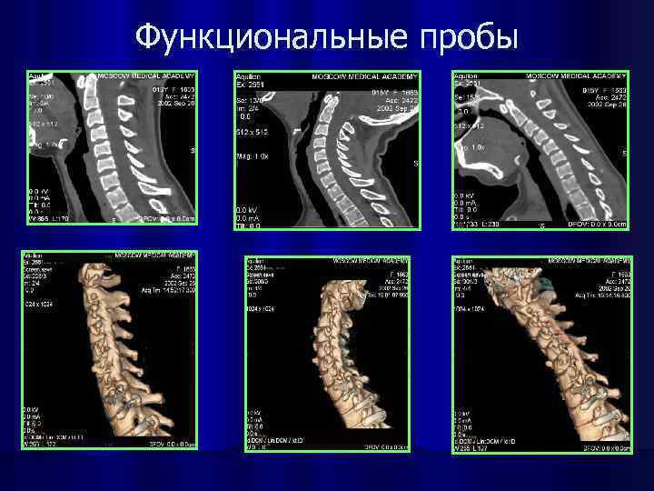 Функциональные пробы 