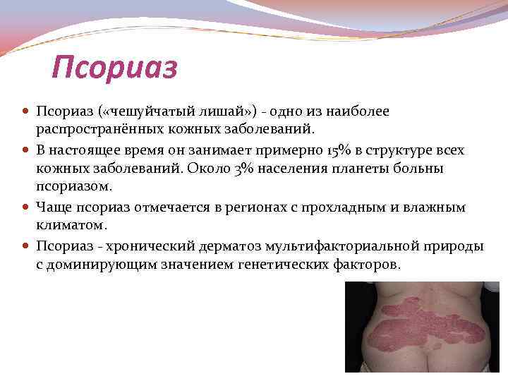 Псориаз ( «чешуйчатый лишай» ) одно из наиболее распространённых кожных заболеваний. В настоящее время