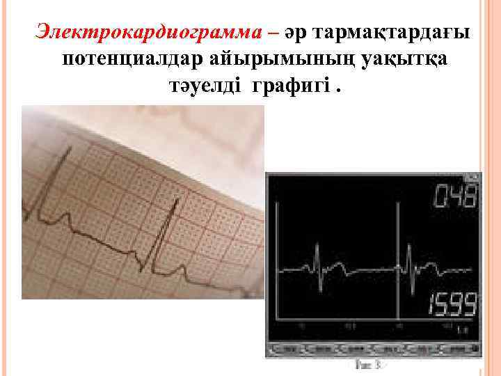 Электрокардиограмма – әр тармақтардағы потенциалдар айырымының уақытқа тәуелді графигі. 