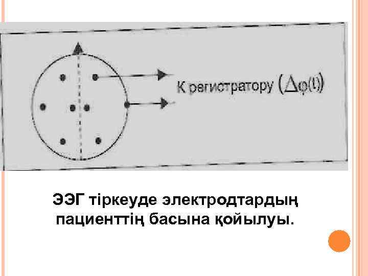 ЭЭГ тіркеуде электродтардың пациенттің басына қойылуы. 