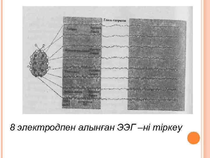8 электродпен алынған ЭЭГ –ні тіркеу 