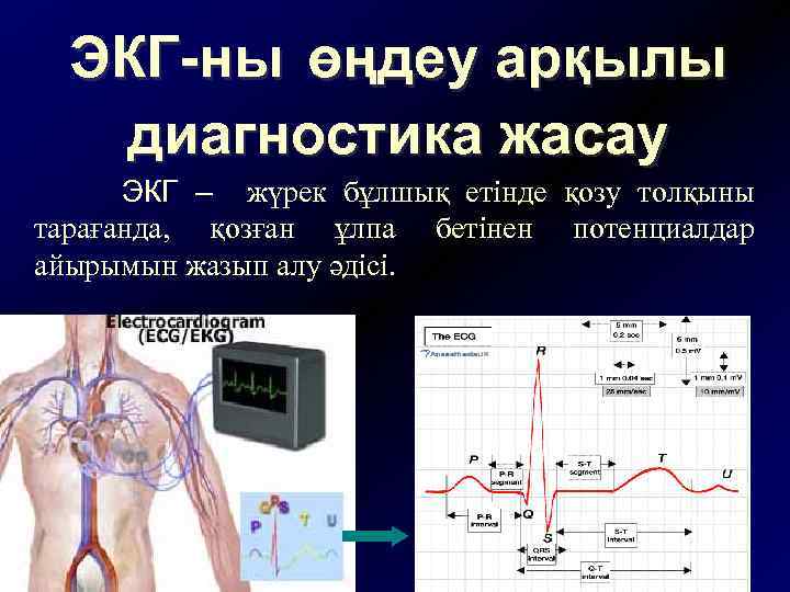 ЭКГ-ны өңдеу арқылы диагностика жасау ЭКГ – жүрек бұлшық етінде қозу толқыны тарағанда, қозған