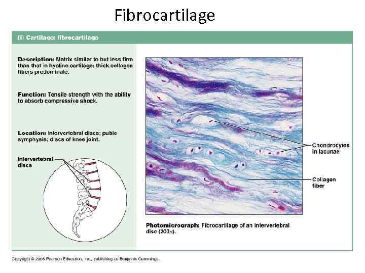 Fibrocartilage 