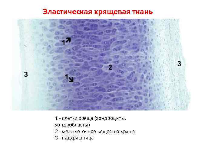 Субплевральный узел незрелой хрящевой ткани