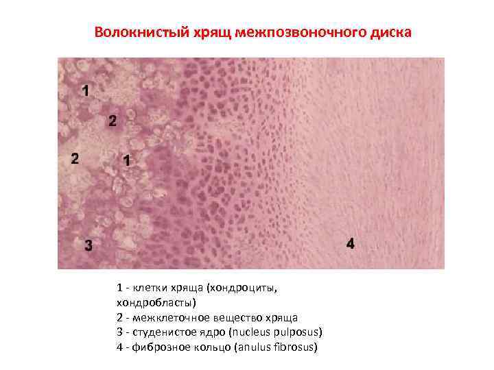 Волокнистый хрящ гистология