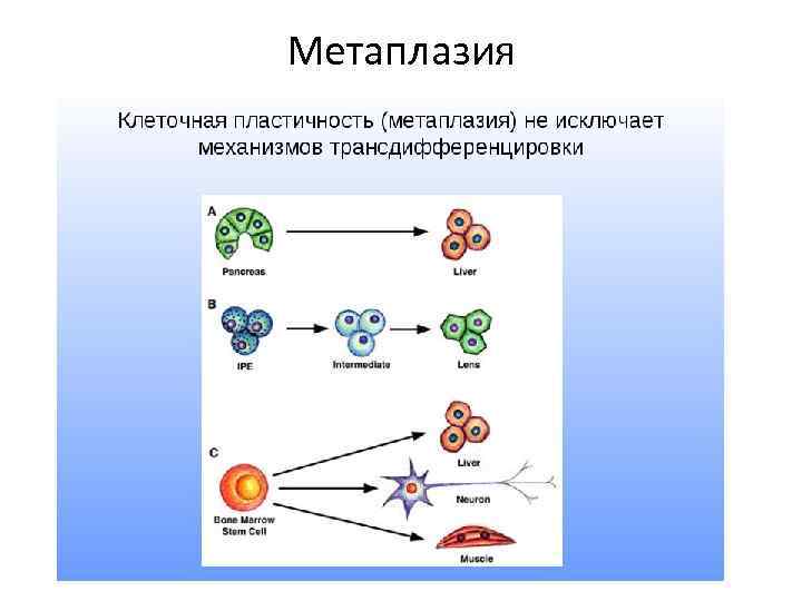 Метаплазия 