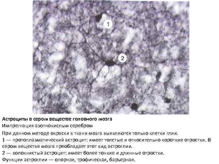 Астроциты в сером веществе головного мозга Импрегнация азотнокислым серебром При данном методе окраски в