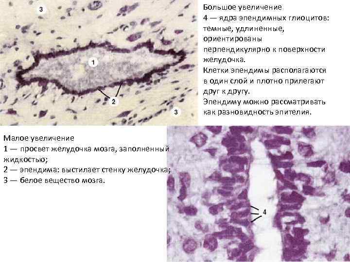 Большое увеличение 4 — ядра эпендимных глиоцитов: темные, удлиненные, ориентированы перпендикулярно к поверхности желудочка.