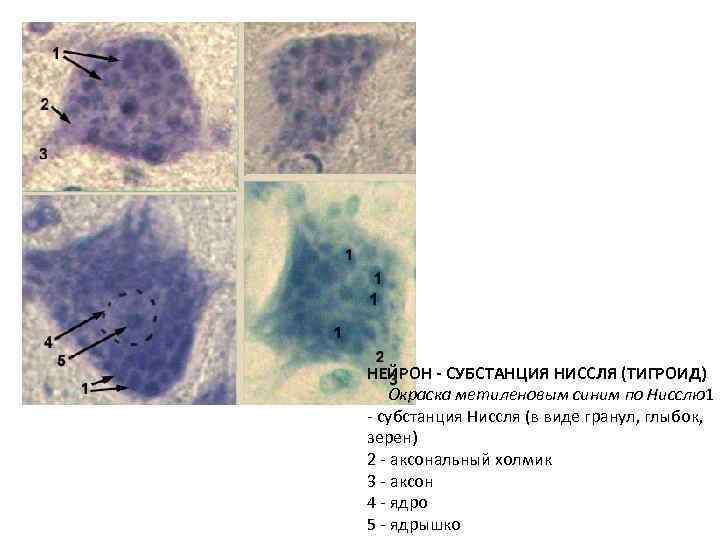 НЕЙРОН - СУБСТАНЦИЯ НИССЛЯ (ТИГРОИД) Окраска метиленовым синим по Нисслю1 - субстанция Ниссля (в