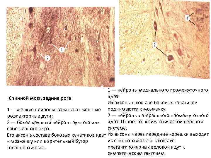 1 — нейроны медиального промежуточного ядра. Спинной мозг, задние рога Их аксоны в составе