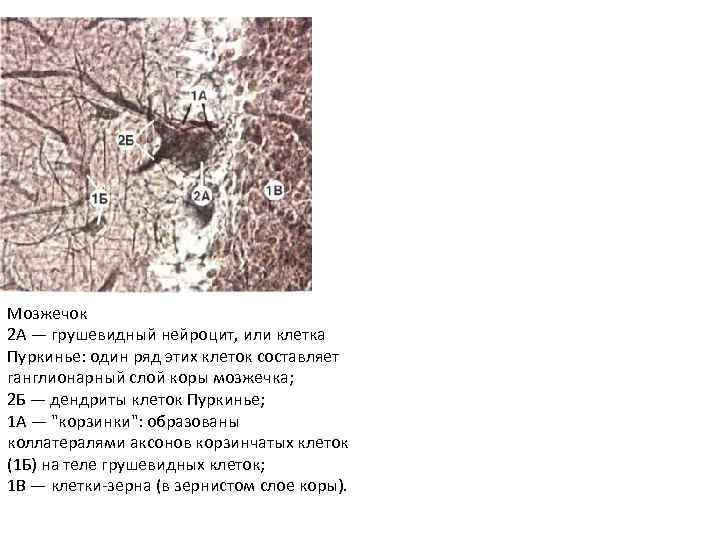 Мозжечок 2 А — грушевидный нейроцит, или клетка Пуркинье: один ряд этих клеток составляет