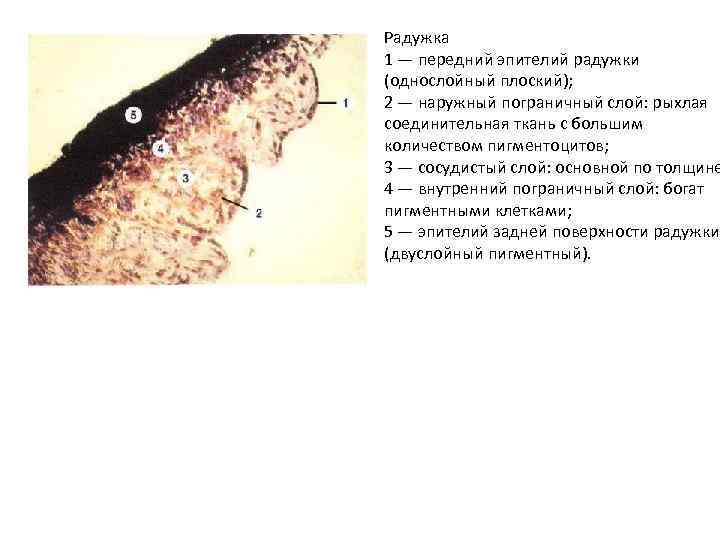 Радужка 1 — передний эпителий радужки (однослойный плоский); 2 — наружный пограничный слой: рыхлая