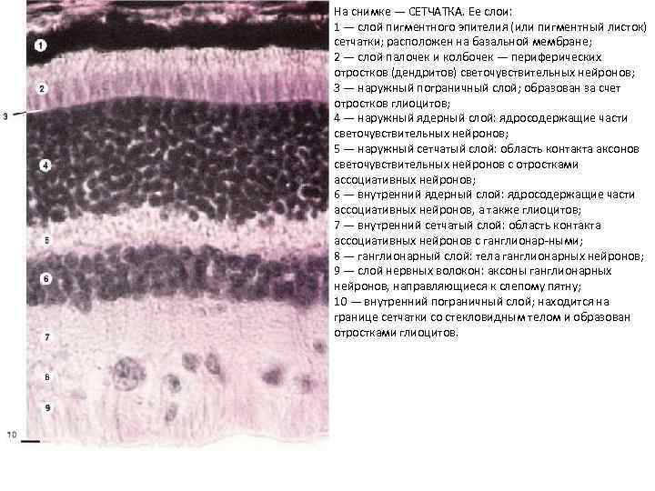 На снимке — СЕТЧАТКА. Ее слои: 1 — слой пигментного эпителия (или пигментный листок)