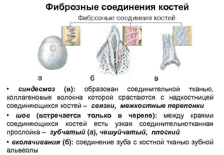 Фиброзные соединения костей • синдесмоз (в): образован соединительной тканью, коллагеновые волокна которой срастаются с