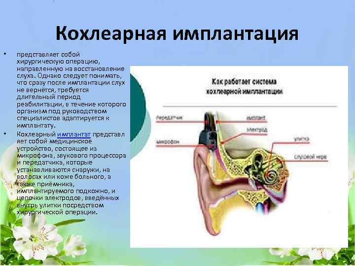 Кохлеарная имплантация • • представляет собой хирургическую операцию, направленную на восстановление слуха. Однако следует