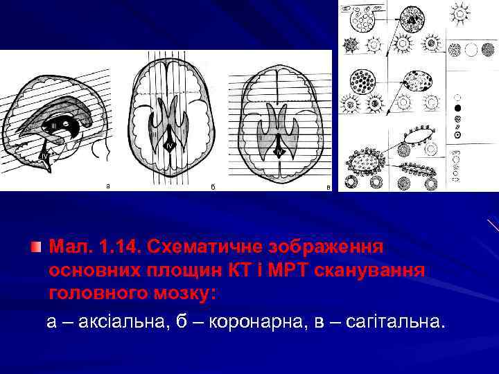 Мал. 1. 14. Схематичне зображення основних площин КТ і МРТ сканування головного мозку: а
