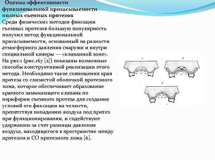  Оценка эффективности функциональной присасываемости полных съемных протезов Среди физических методов фиксации съемных протезов