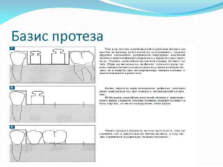 Базис протеза 