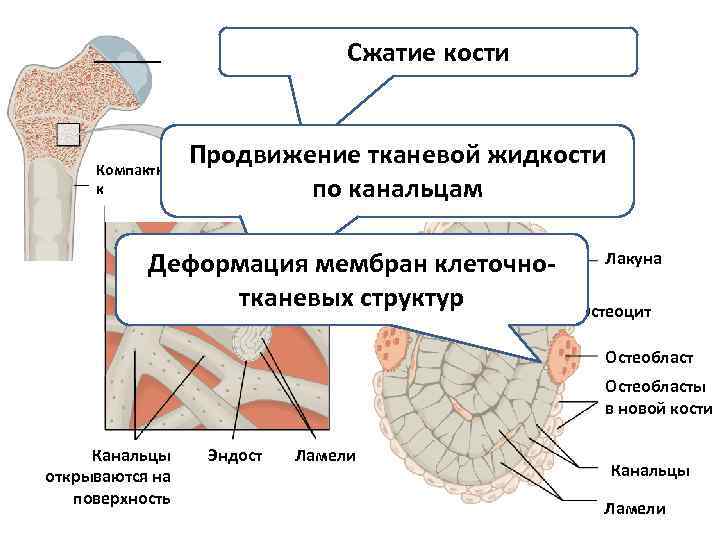 Сжатие костей