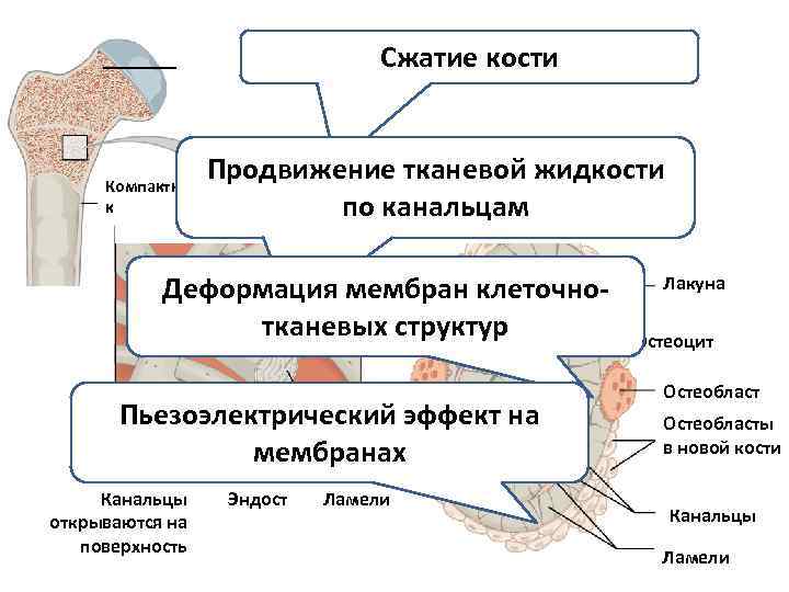 Сжатие костей