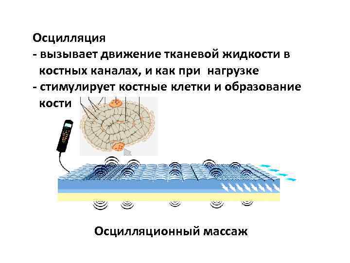 Осцилляция - вызывает движение тканевой жидкости в костных каналах, и как при нагрузке -