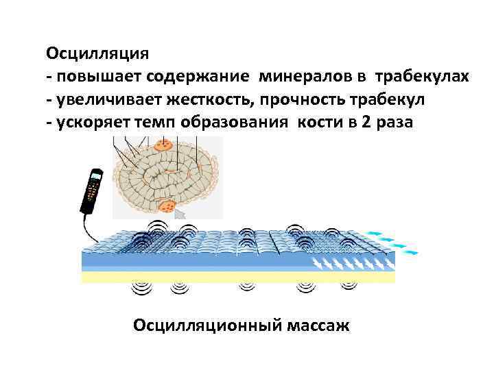 Осцилляция - повышает содержание минералов в трабекулах - увеличивает жесткость, прочность трабекул - ускоряет