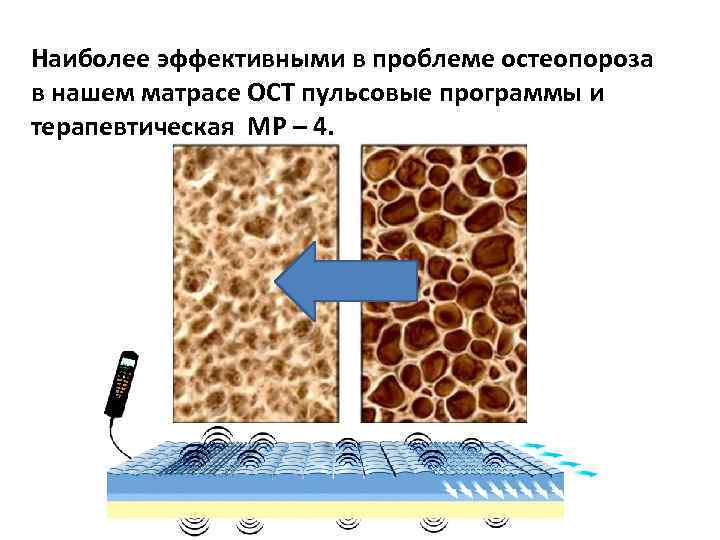 Центр остеопороза. Как влияет курение на остеопороз. Котельников г.п. 