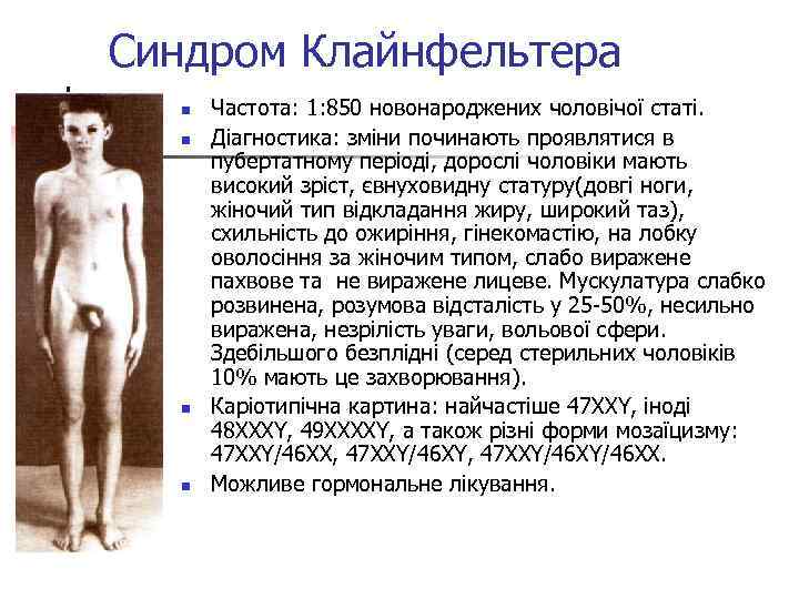 Синдром Клайнфельтера n n Частота: 1: 850 новонароджених чоловічої статі. Діагностика: зміни починають проявлятися