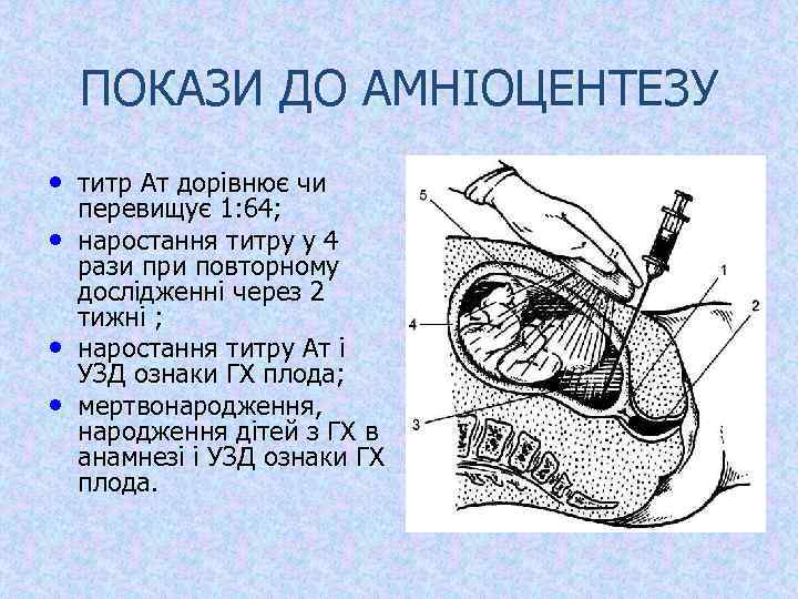 ПОКАЗИ ДО АМНІОЦЕНТЕЗУ • титр Ат дорівнює чи • • • перевищує 1: 64;