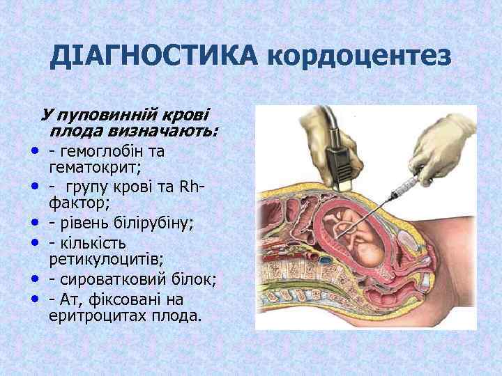 ДІАГНОСТИКА кордоцентез У пуповинній крові плода визначають: • - гемоглобін та • • •