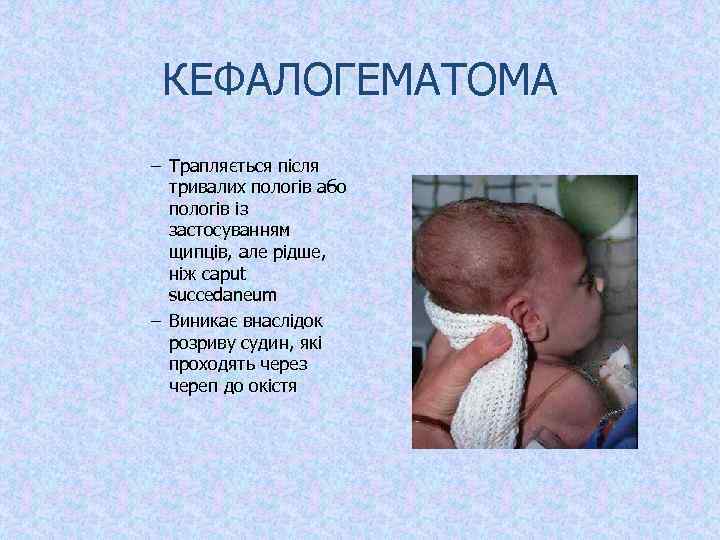 КЕФАЛОГЕМАТОМА – Трапляється після тривалих пологів або пологів із застосуванням щипців, але рідше, ніж