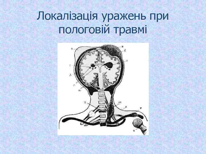 Локалізація уражень при пологовій травмі 