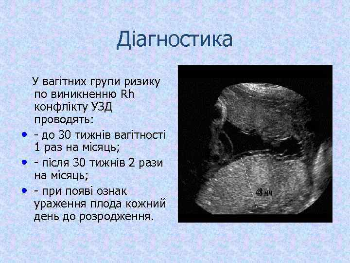 Діагностика У вагітних групи ризику по виникненню Rh конфлікту УЗД проводять: • - до