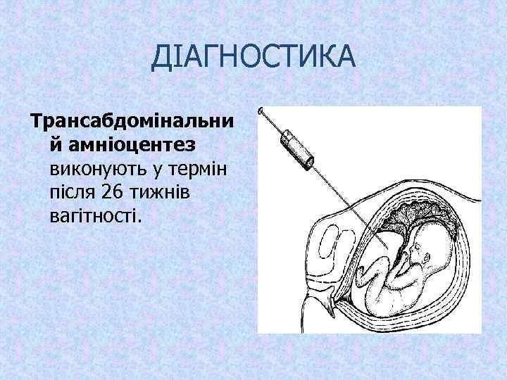 ДІАГНОСТИКА Трансабдомінальни й амніоцентез виконують у термін після 26 тижнів вагітності. 