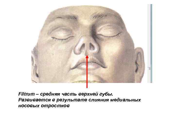 Filtrum – средняя часть верхней губы. Развивается в результате слияния медиальных носовых отростков 