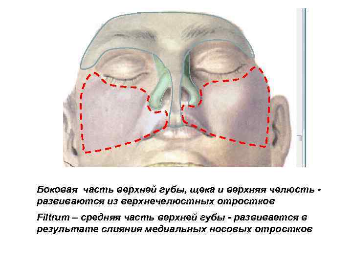 Боковая часть верхней губы, щека и верхняя челюсть развиваются из верхнечелюстных отростков Filtrum –