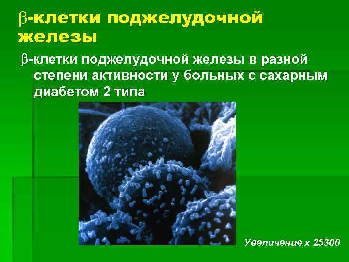  -клетки поджелудочной железы в разной степени активности у больных с сахарным диабетом 2