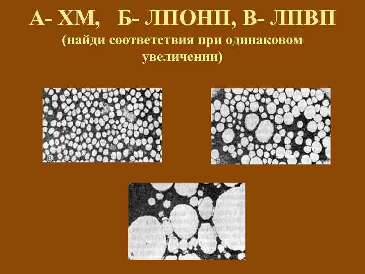 А- ХМ, Б- ЛПОНП, В- ЛПВП (найди соответствия при одинаковом увеличении) 