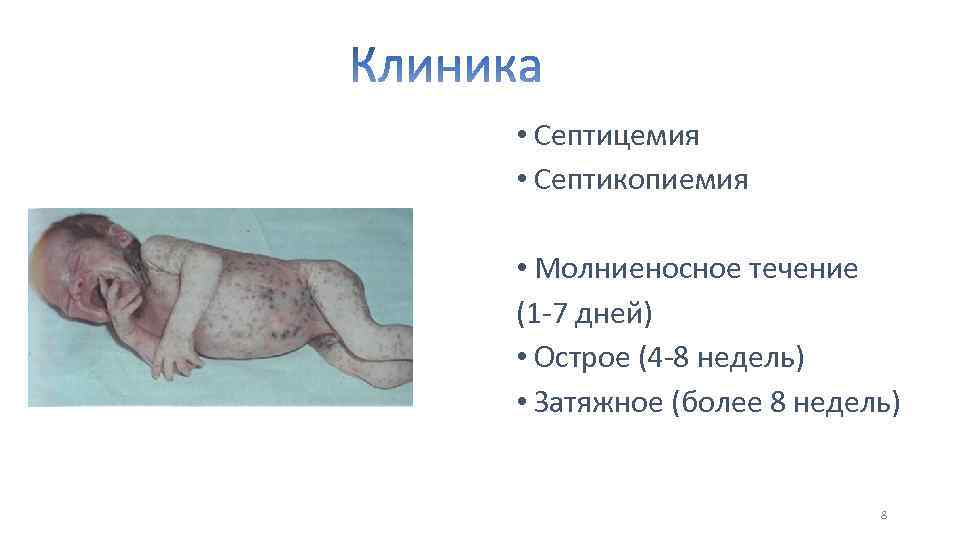  • Септицемия • Септикопиемия • Молниеносное течение (1 -7 дней) • Острое (4