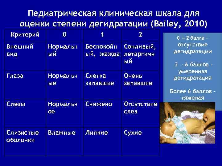 Педиатрическая клиническая шкала для оценки степени дегидратации (Bailey, 2010) Критерий Внешний вид Глаза 0