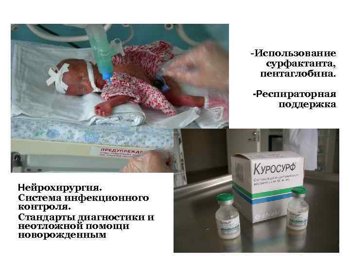 -Использование сурфактанта, пентаглобина. -Респираторная поддержка Нейрохирургия. Система инфекционного контроля. Стандарты диагностики и неотложной помощи