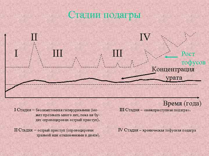 Стадии подагры II I IV III Рост тофусов Концентрация урата Время (года) I Стадия