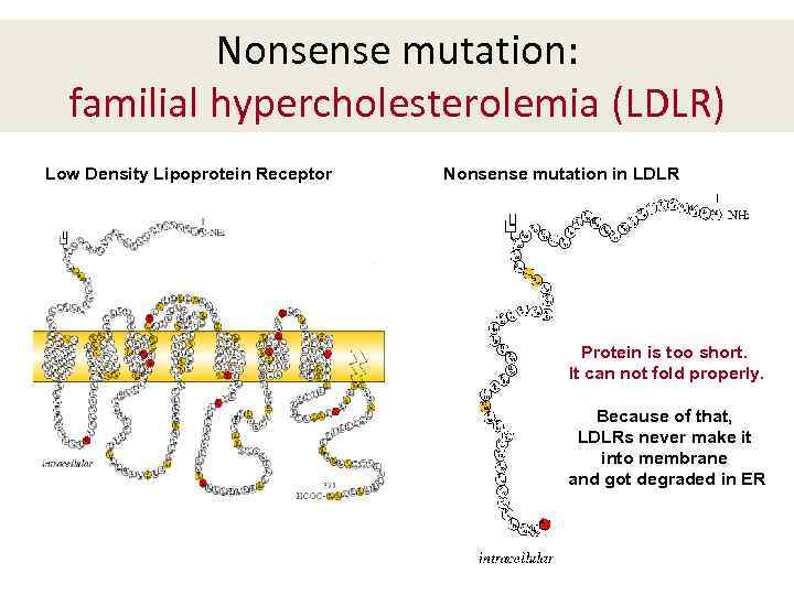 Nonsense mutation: familial hypercholesterolemia (LDLR) Low Density Lipoprotein Receptor Nonsense mutation in LDLR Protein