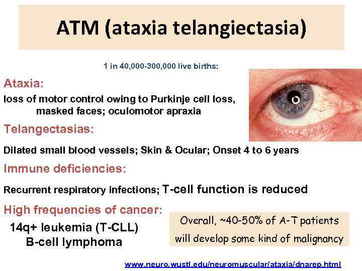 ATM (ataxia telangiectasia) 1 in 40, 000 -300, 000 live births: Ataxia: loss of