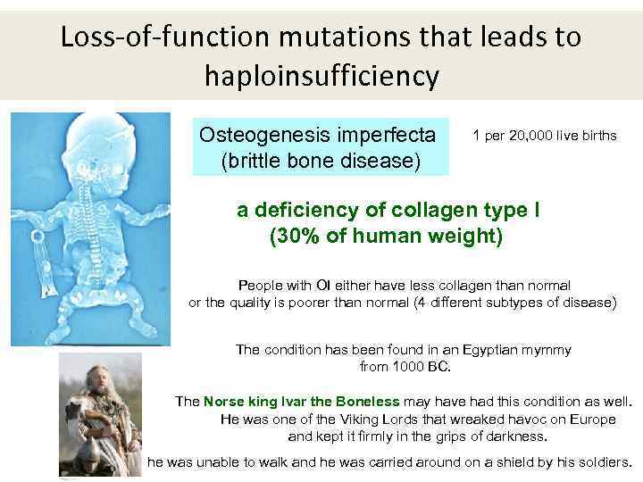 Loss-of-function mutations that leads to haploinsufficiency Osteogenesis imperfecta (brittle bone disease) 1 per 20,