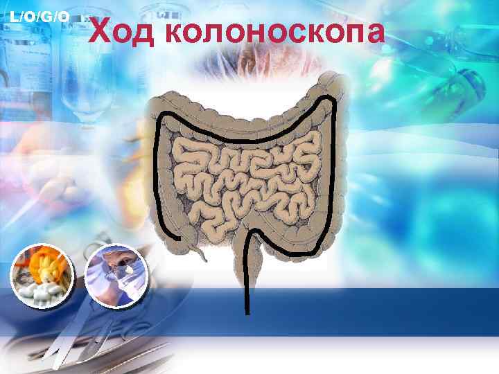 L/O/G/O Ход колоноскопа 