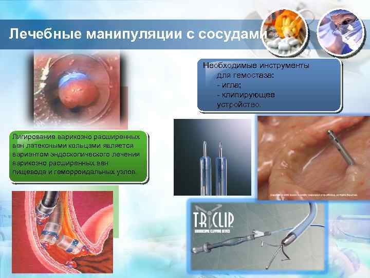 Лечебные манипуляции с сосудами Необходимые инструменты для гемостаза: - игла; - клипирующее устройство. Лигирование