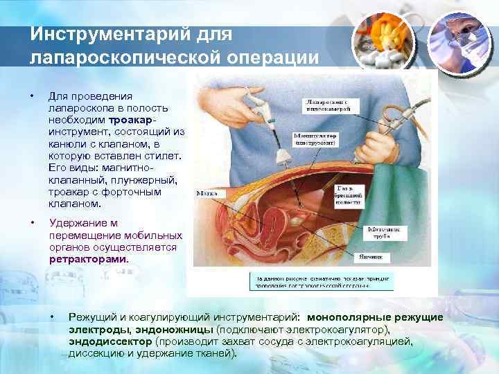 Инструментарий для лапароскопической операции • Для проведения лапароскопа в полость необходим троакар- инструмент, состоящий